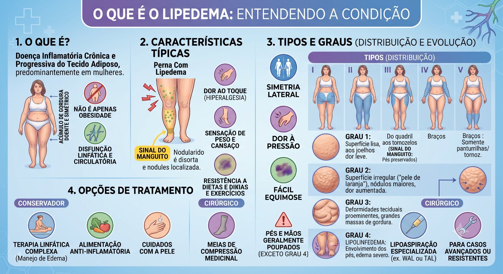 Infográfico dos graus (I a IV) e tipos (I a V) de lipedema